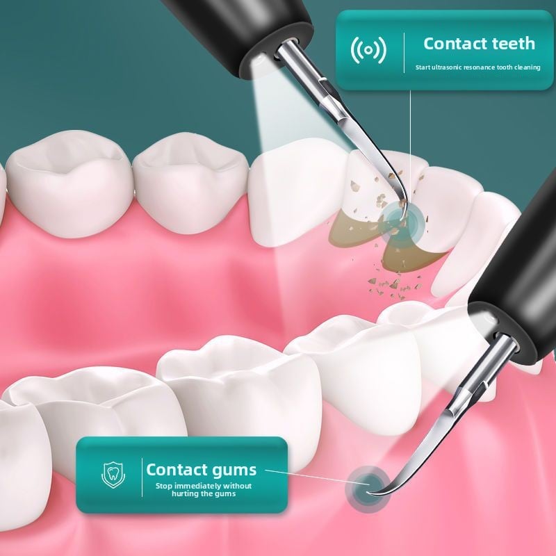 Ultrasonic dental cleaner